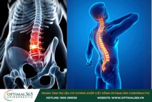 Những thói quen cần tránh để làm sao để không bị thoát vị đĩa đệm
