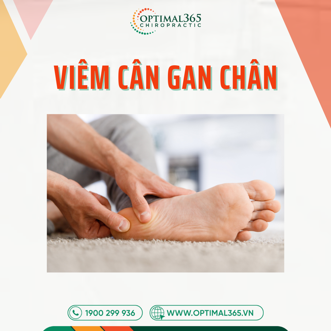 Viêm cân gan chân là gì? Hướng dẫn điều trị không cần phẫu thuật