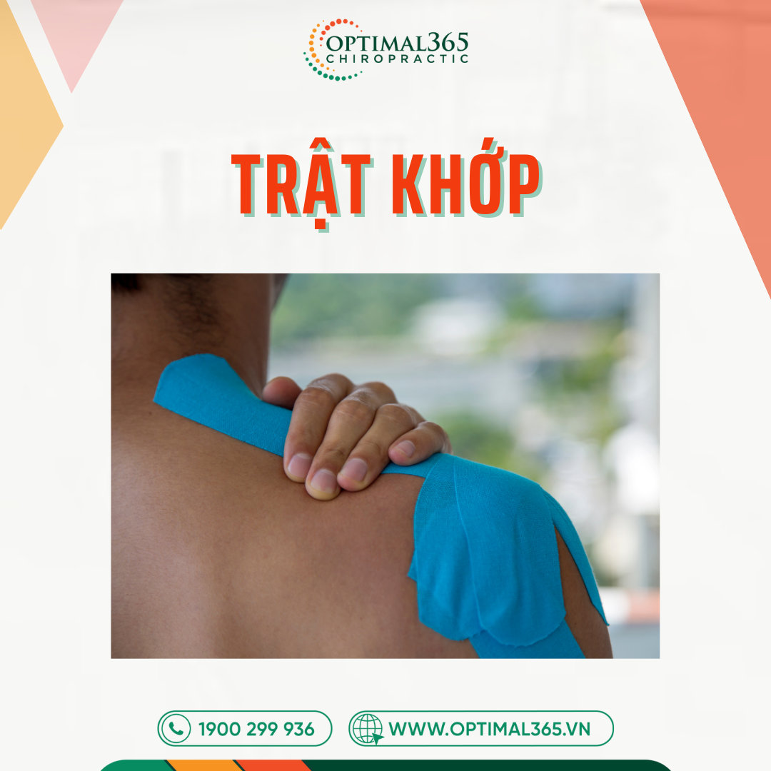 Trật khớp là gì? Dấu hiệu nhận biết và cách xử lý đúng cách