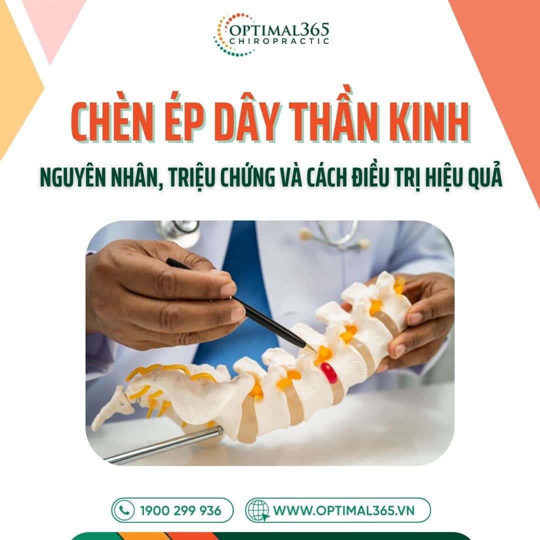 Chèn ép dây thần kinh: Nguyên nhân, triệu chứng và cách điều trị hiệu quả