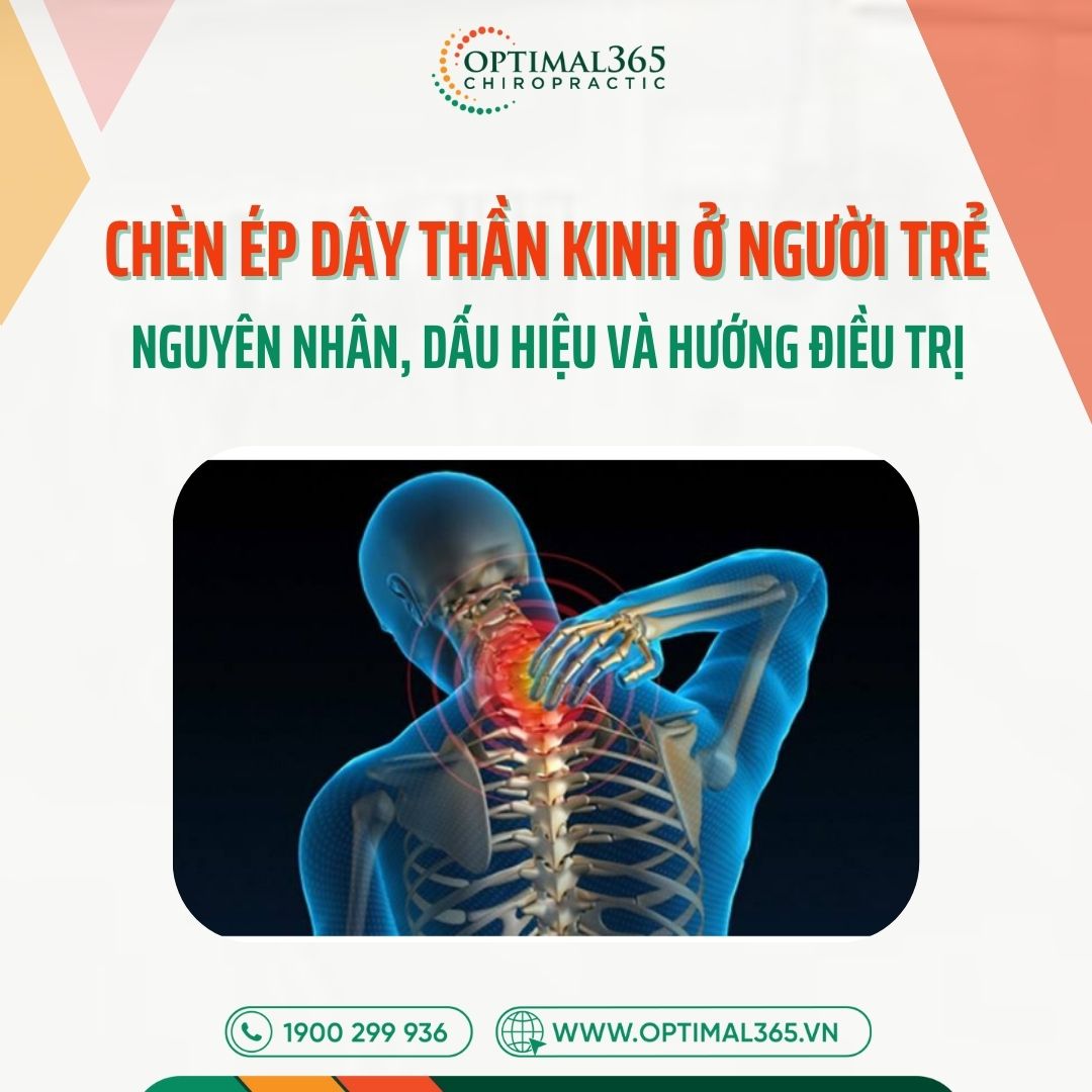 Chèn ép dây thần kinh ở người trẻ: Nguyên nhân, dấu hiệu và hướng điều trị