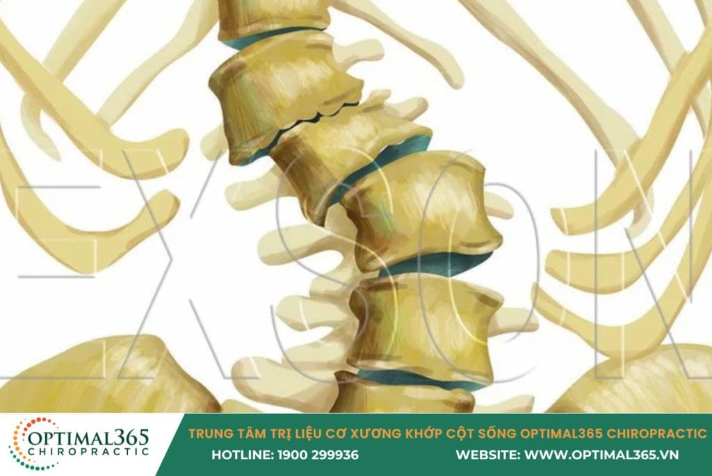 trượt đốt sống