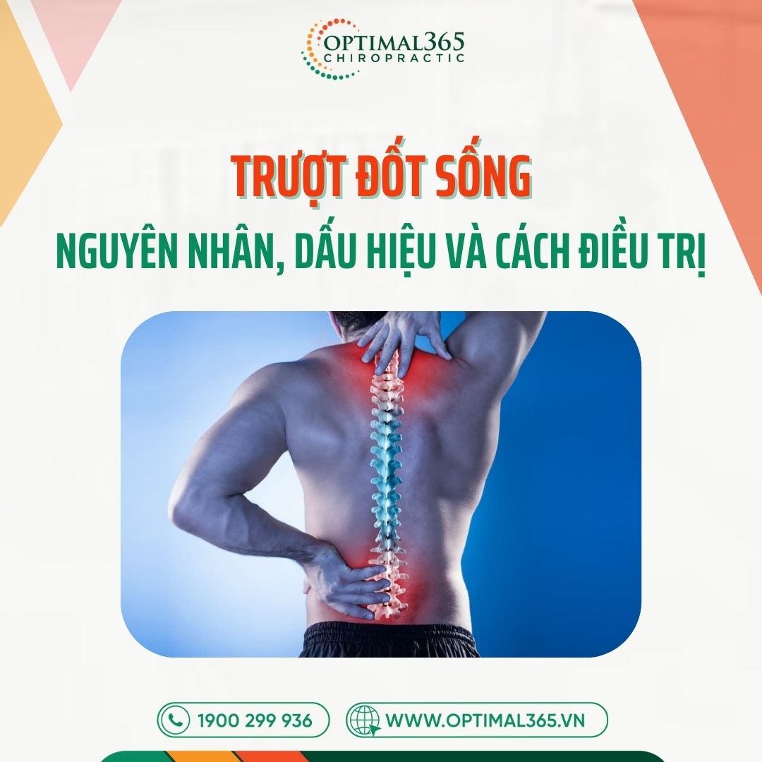 Trượt đốt sống: Nguyên nhân, dấu hiệu và cách điều trị