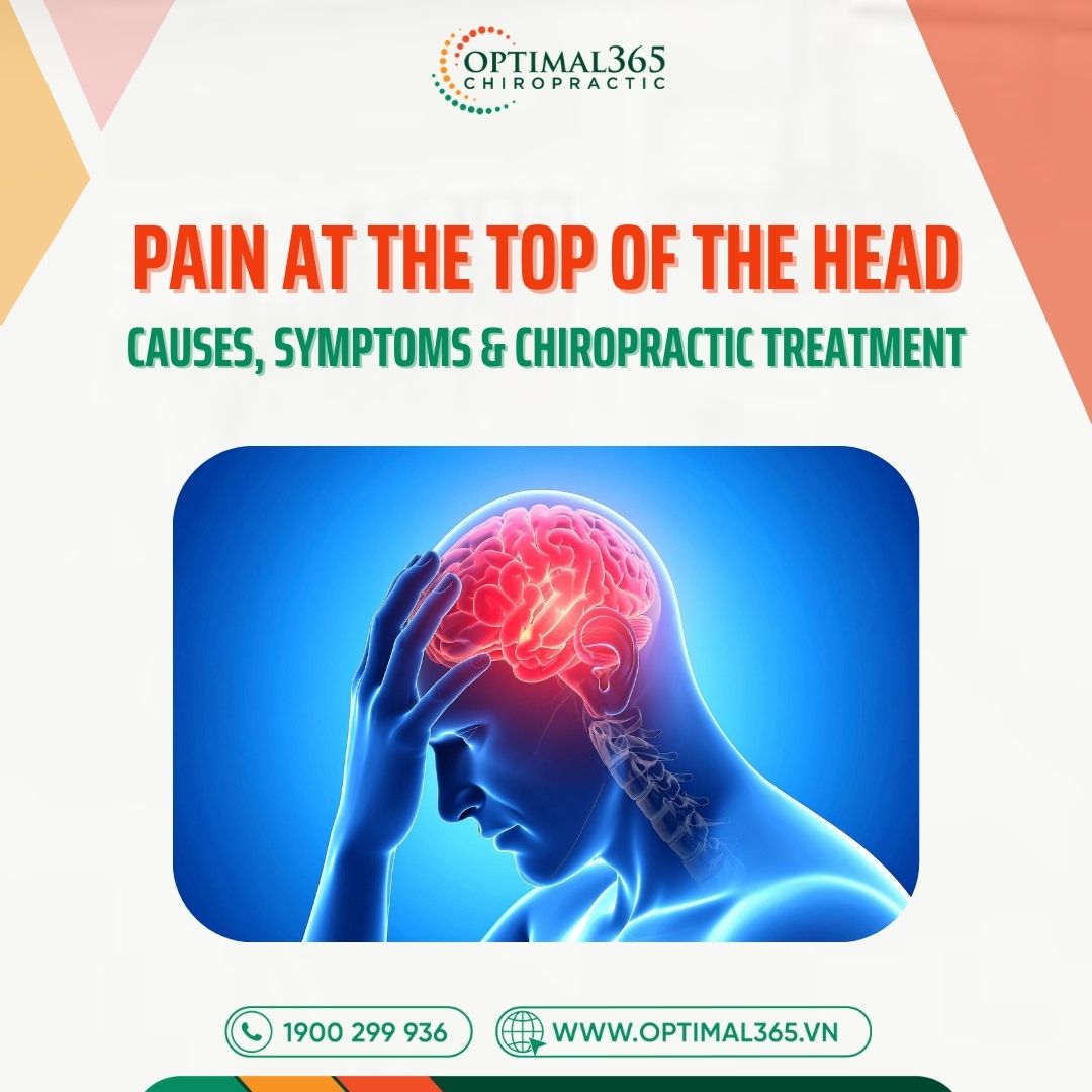 Pain at the Top of the Head: Causes, Symptoms & Chiropractic Treatment 2026