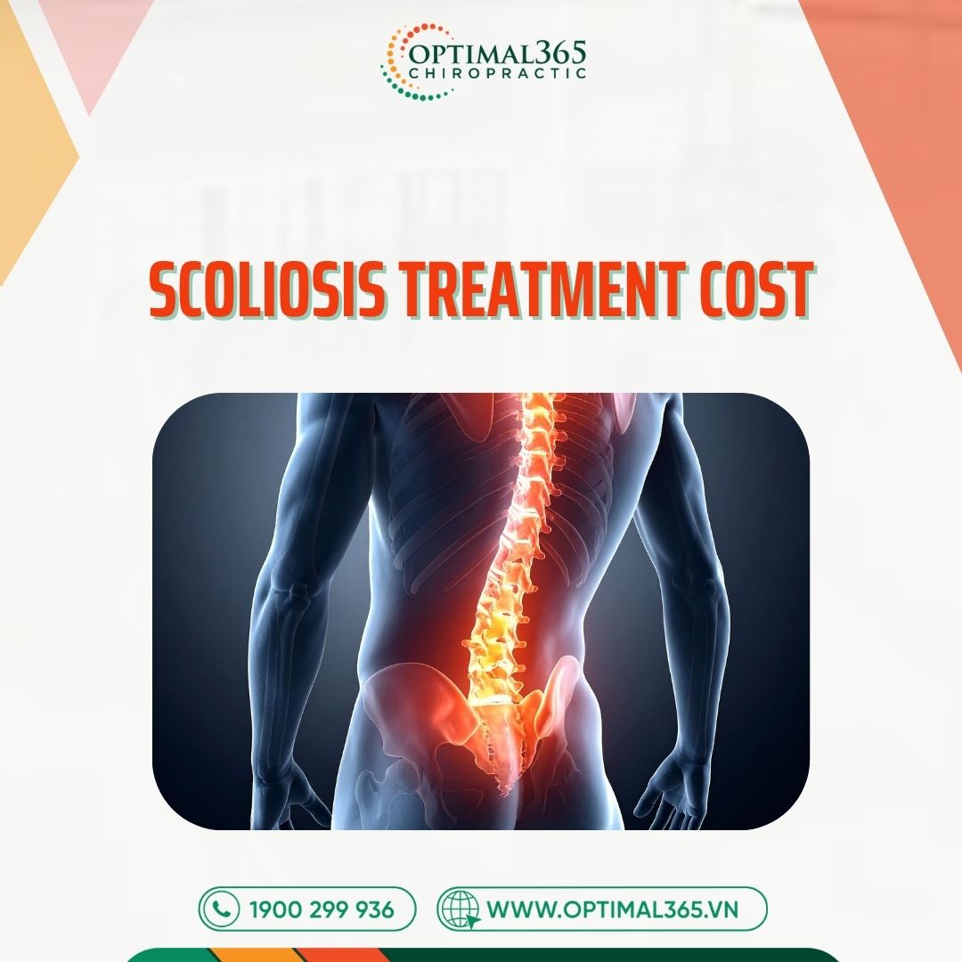 Scoliosis Treatment Cost in Vietnam 2026: Full Breakdown & Options