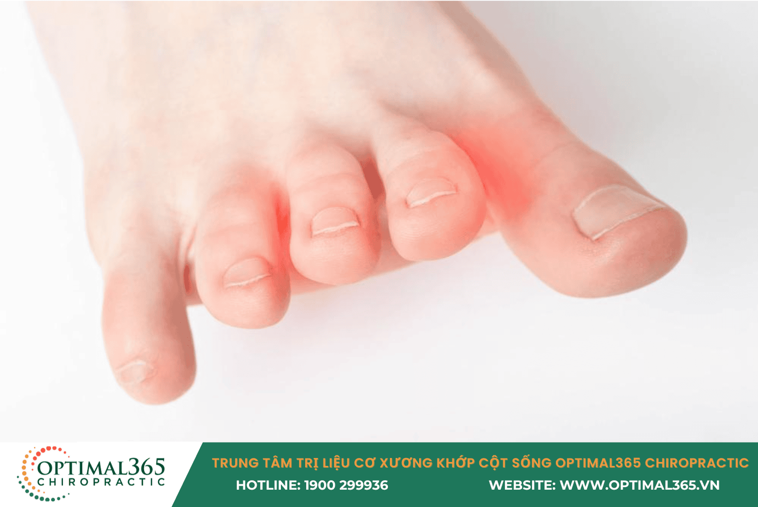 Chuột rút bàn chân