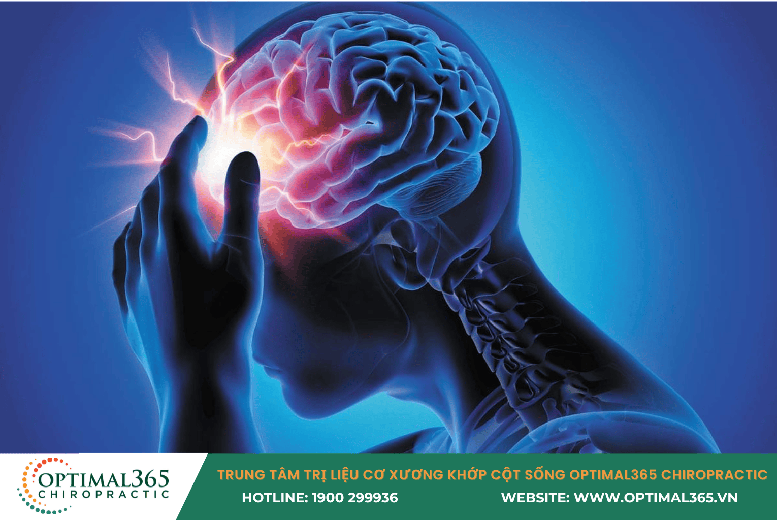 Thay đổi thời tiết đau đầu là gì?