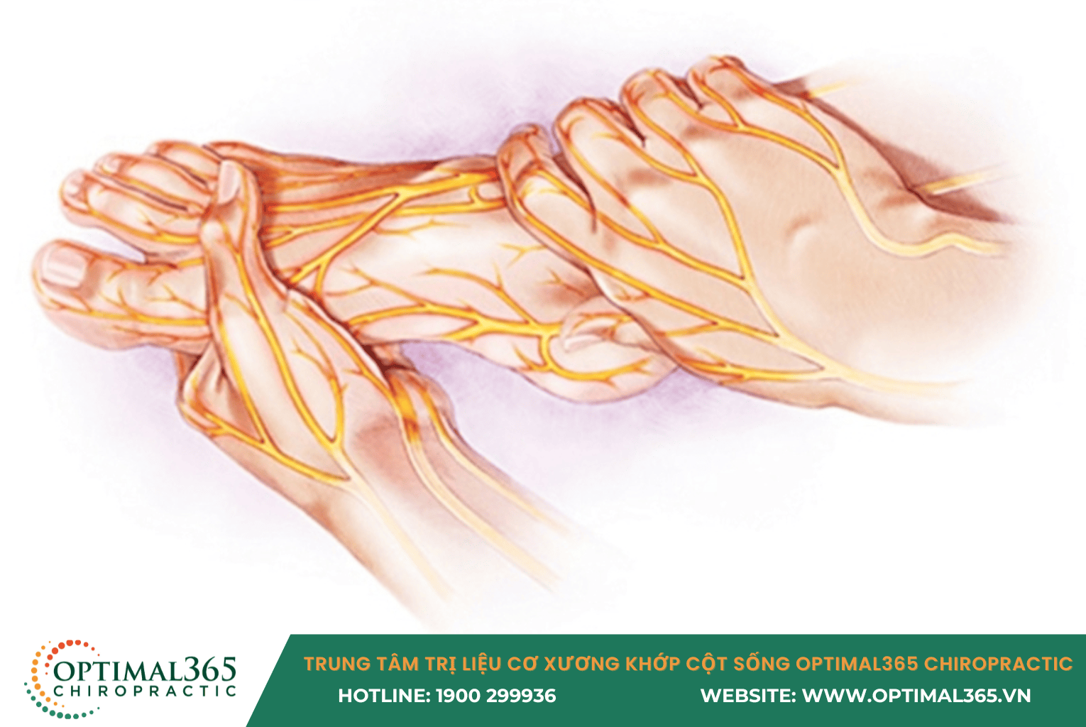 Viêm dây thần kinh ngoại biên