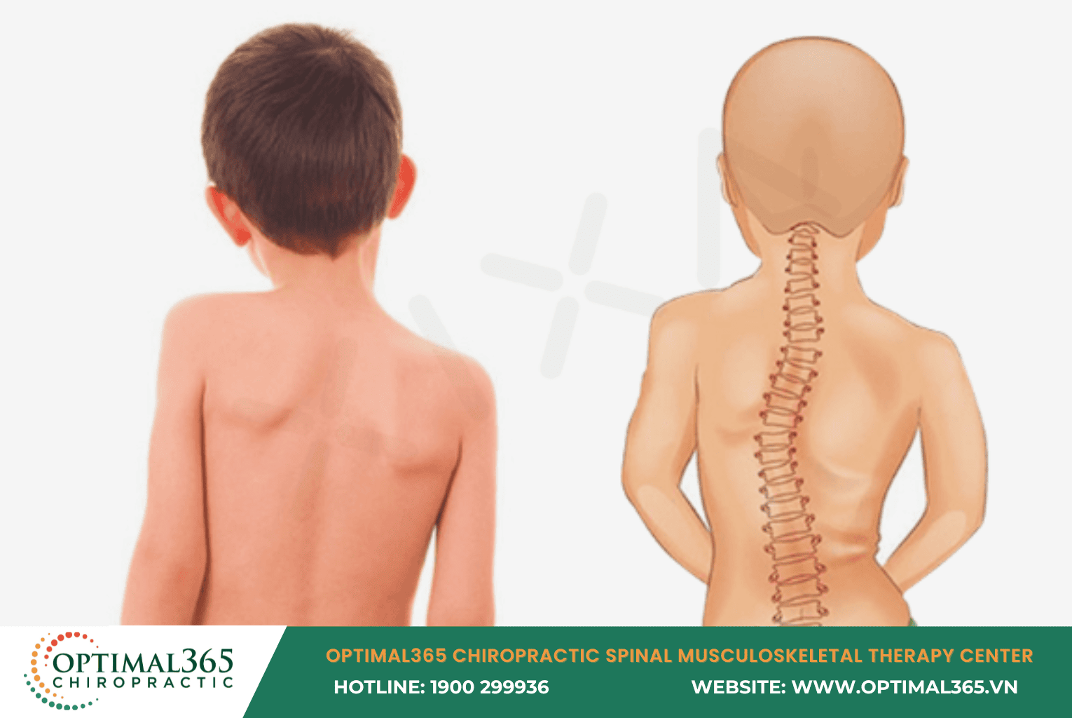 Warning Signs That Require an Immediate Spinal Checkup