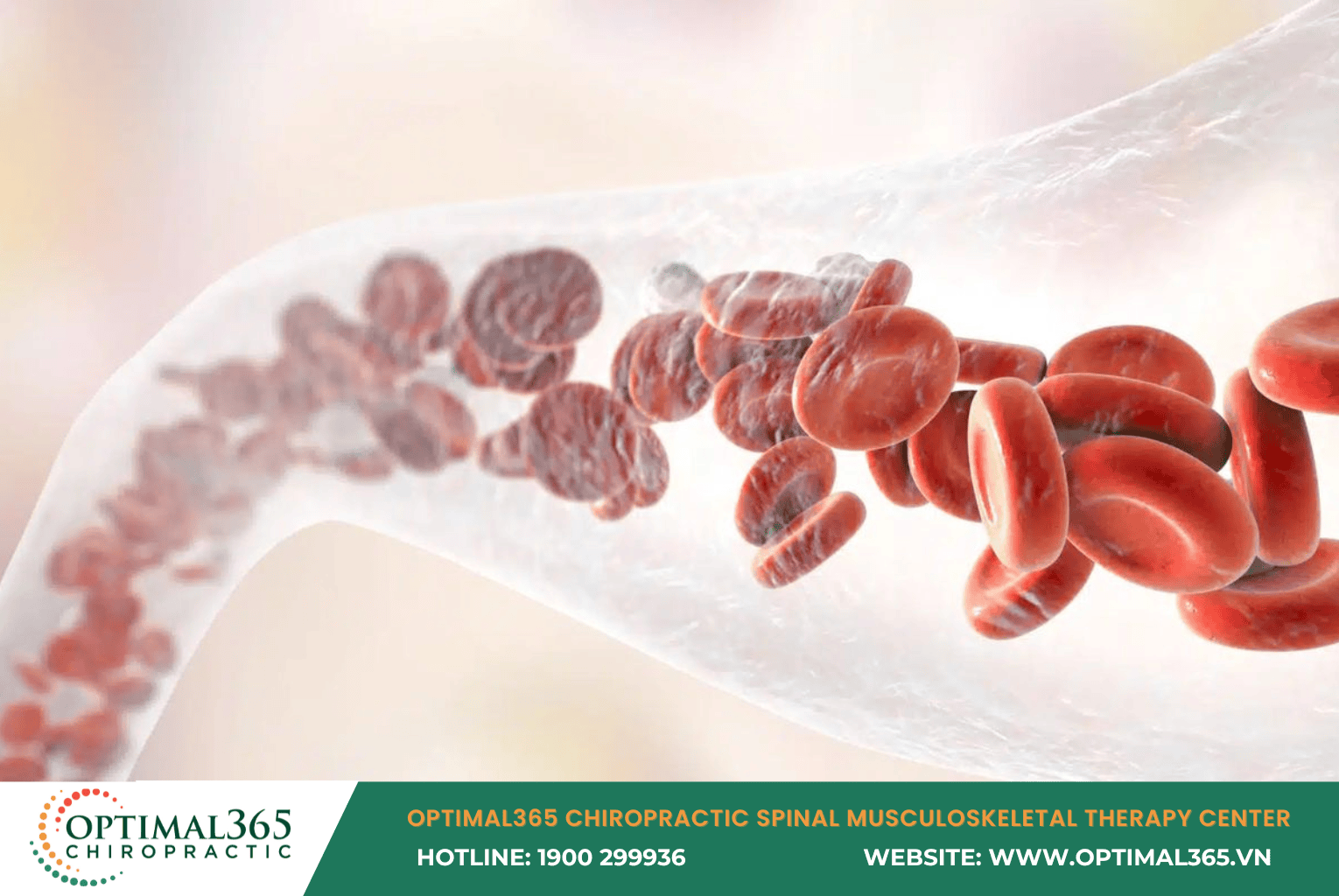 Circulatory Disorders