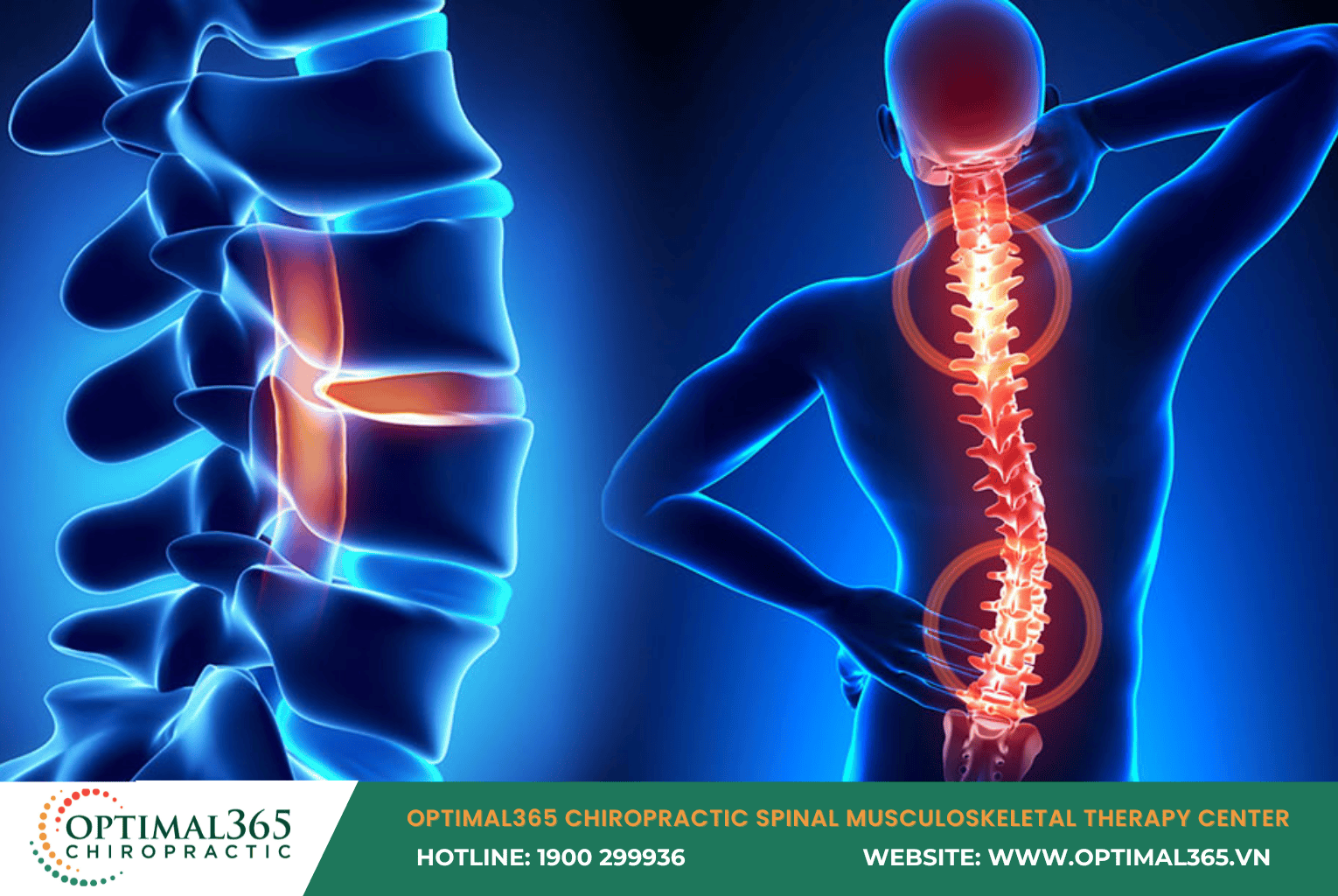 Musculoskeletal Conditions