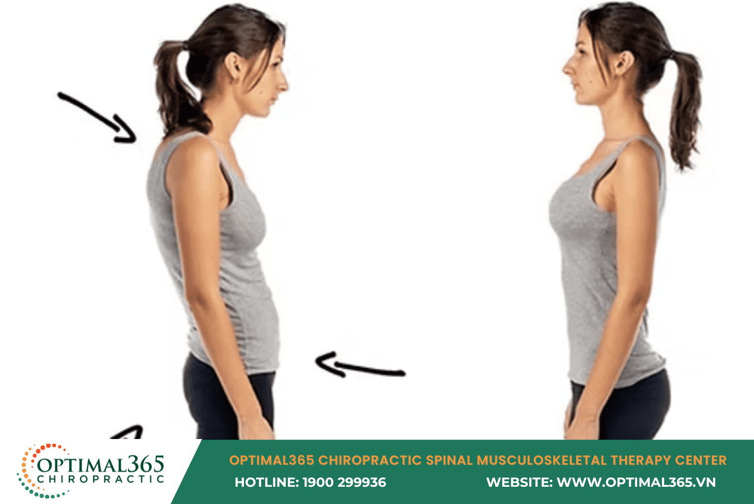 Người tập bài pelvic tilt và glute bridge để khắc phục võng lưng tại nhà