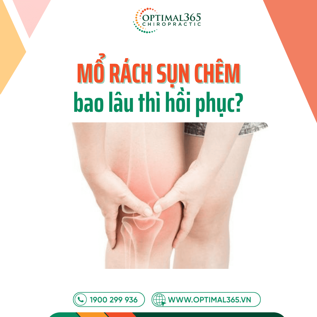 Mổ rách sụn chêm bao lâu thì hồi phục? 4 giai đoạn phục hồi hiệu quả nhất