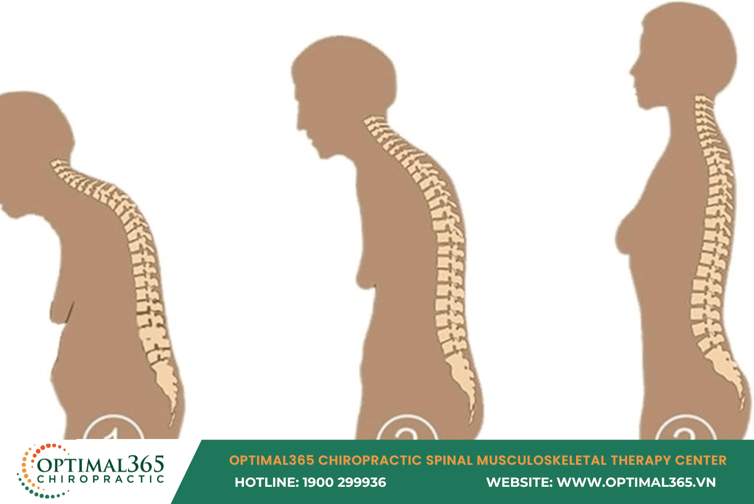 Tư thế đứng và ngồi đúng cách để phòng ngừa và khắc phục võng lưng