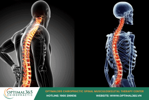 Loss of physiological curves of the spine due to poor sitting posture